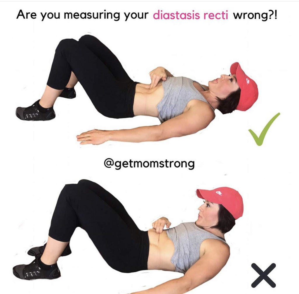 are you measuring your diastasis recti wrong?