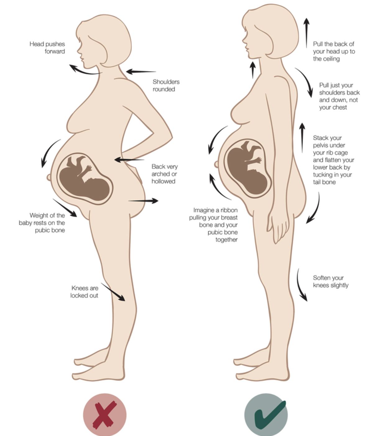 37 недель боли форум. Болит поясница при беременности. Расположение органов у беременных 2 триместр. Позвоночник беременной женщины. Болит в тазовой части у беременных.