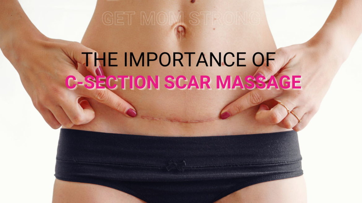 importance of c section scar massage
