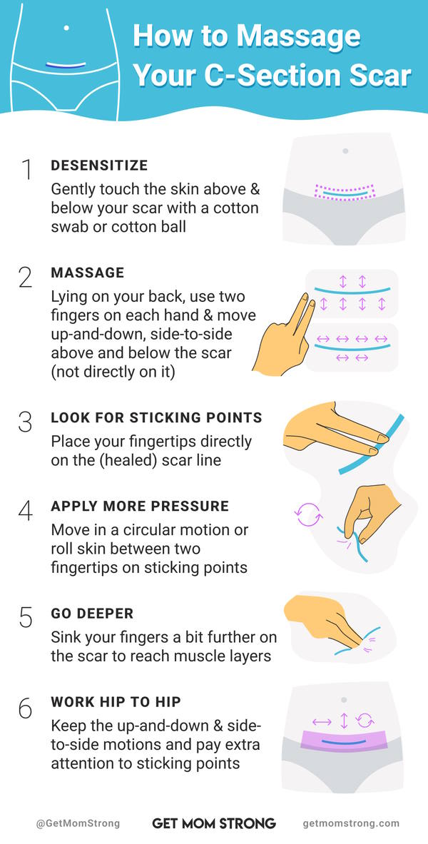 how to massage your c section scar