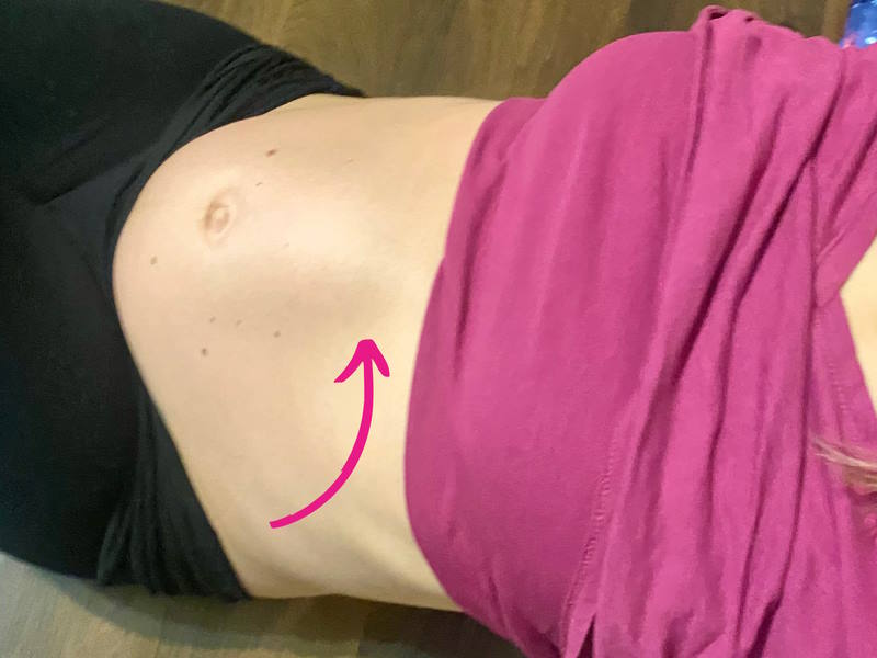 coning during pregnancy
