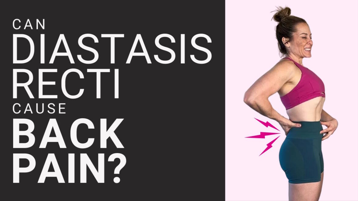 can diastasis recti cause back pain