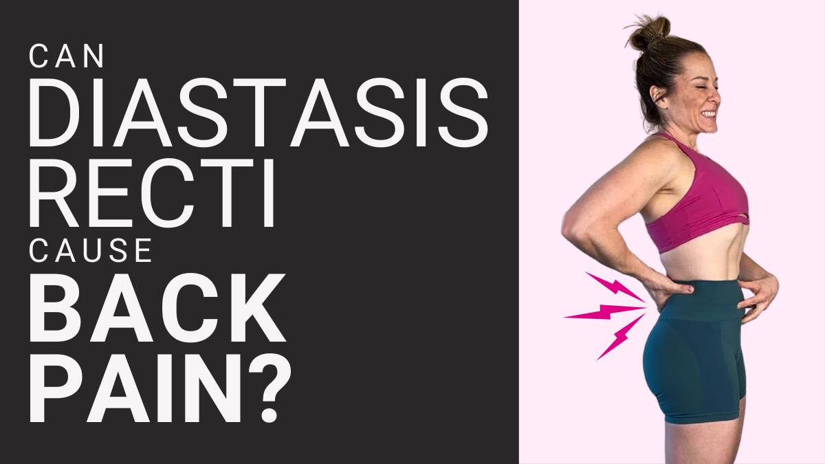 Can Diastasis Recti Cause Back Pain?