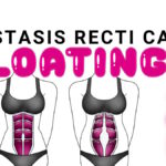 does diastasis recti cause bloating