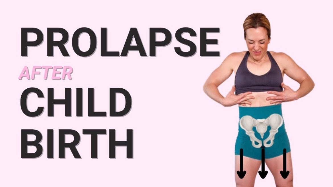 Prolapse After Birth? Find Relief With 3 Simple Moves