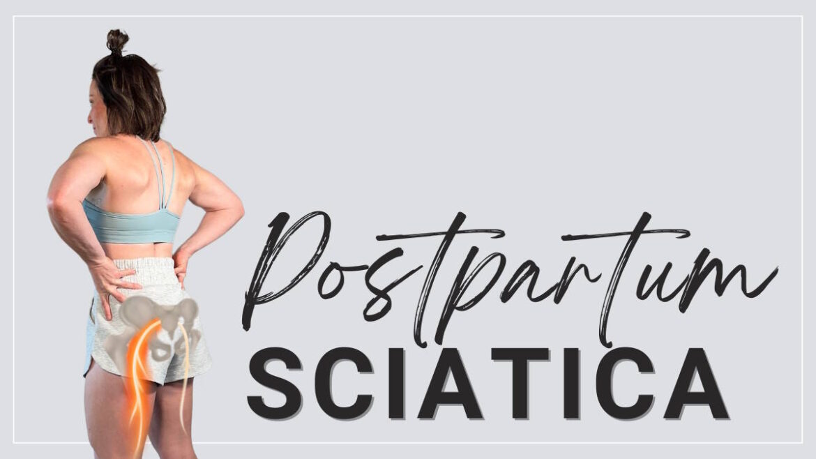 postpartum sciatica